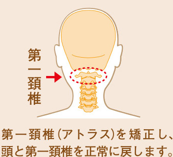 脊椎矯正（アトラス療法）写真2